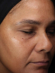 Image of face after using product